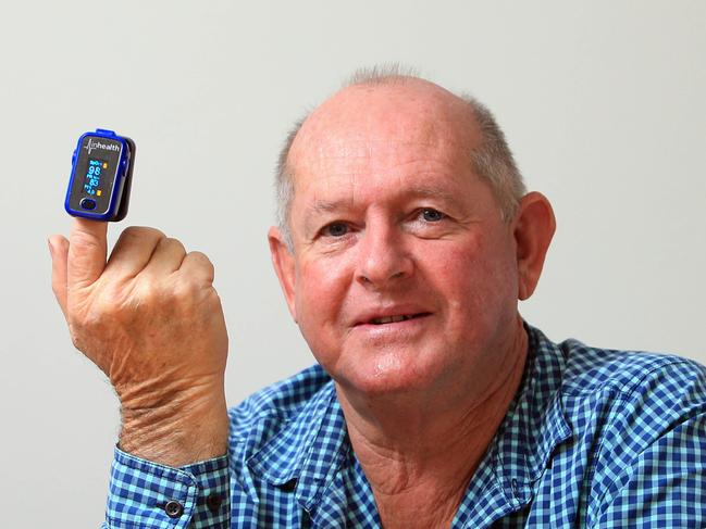 02/06/20 COVID patient David Kirton who used a home device called an oxymetre to measure his blood oxygen levels when he was recovering from COVID-19 at home. Aaron Francis/The Australian