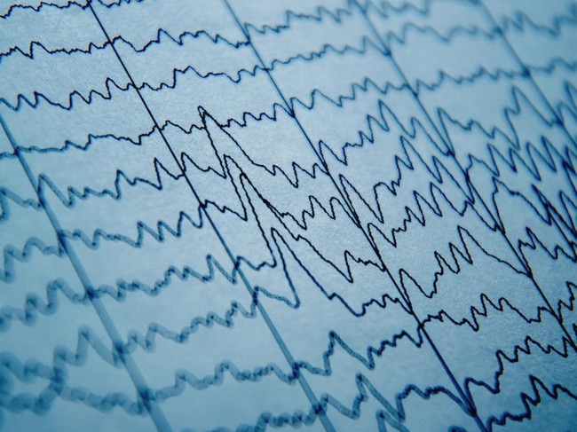 Caffeine increases neural activity during sleep. Picture: iStock