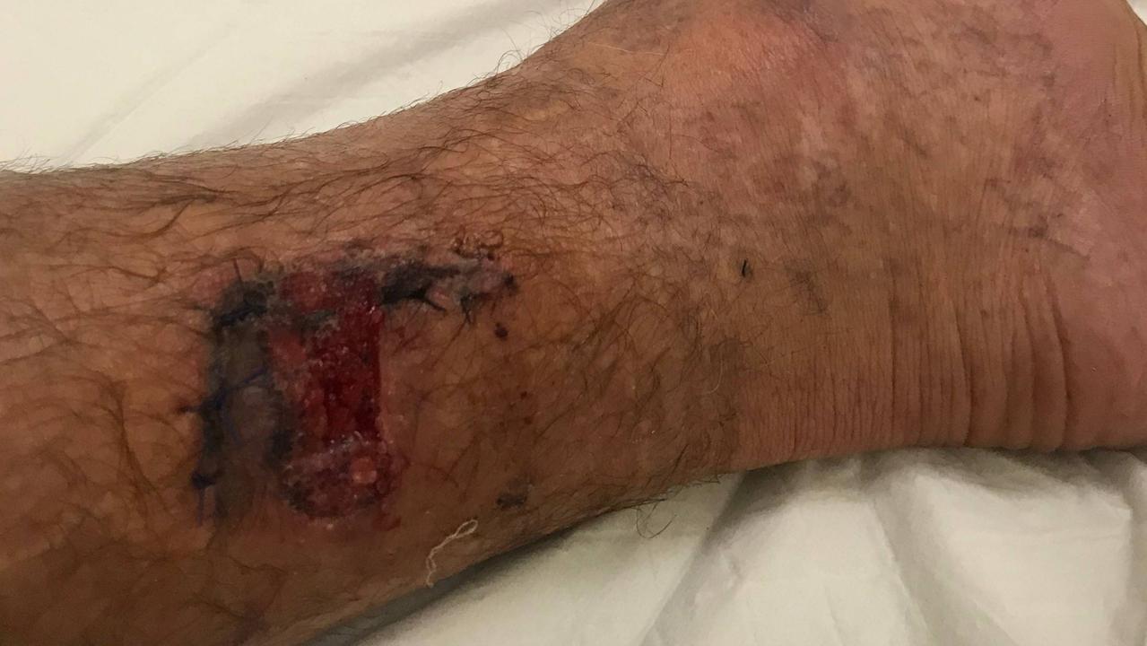Ergon Energy is pleading with Queensland dog owners to properly restrain their pets after more than 270 attacks in the past two years. Picture: Contributed