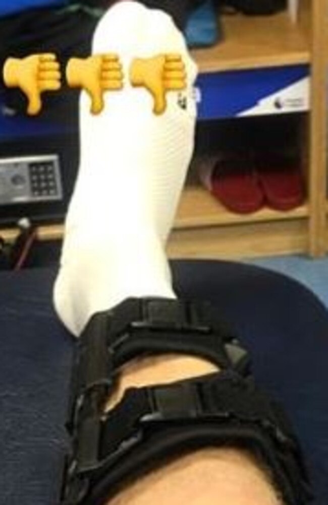 Aaron Mooy's Instagram shot of his injury.