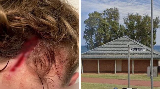 Backpacker bashed by gang in toilet block