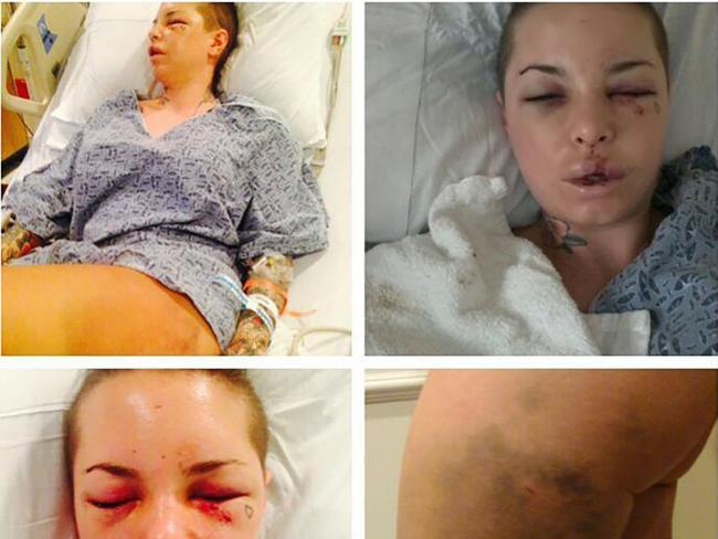 Christy Mack after the alleged attack. Picture: Instagram
