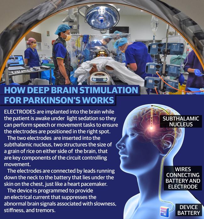 web Brain Parkinson 650 700