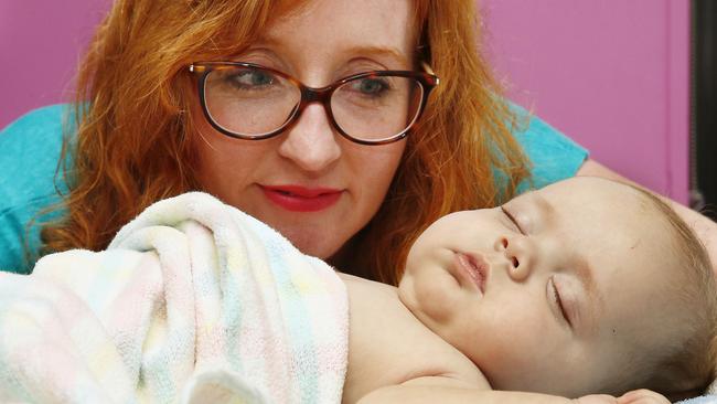 Kidney failure in babies: Sydney infant starts dialysis ...