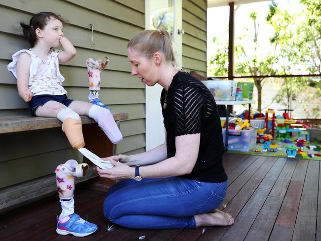 Mia’s mum, Amy, puts on her ‘uncomfortable’ legs before school. Picture: Tara Croser