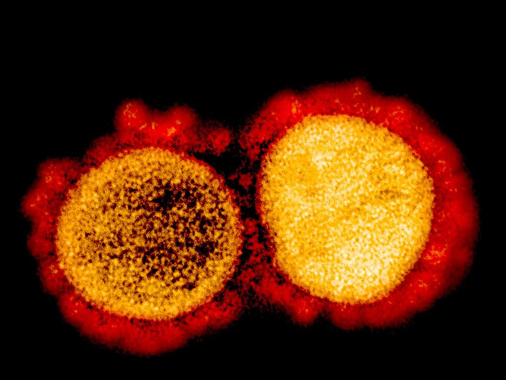 This image shows a transmission electron micrograph of SARS-CoV-2 virus particles, isolated from a patient, captured and colour-enhanced at the NIAID Integrated Research Facility (IRF) in Fort Detrick, Maryland. Picture: National Institute of Allergy and Infectious Diseases / AFP.