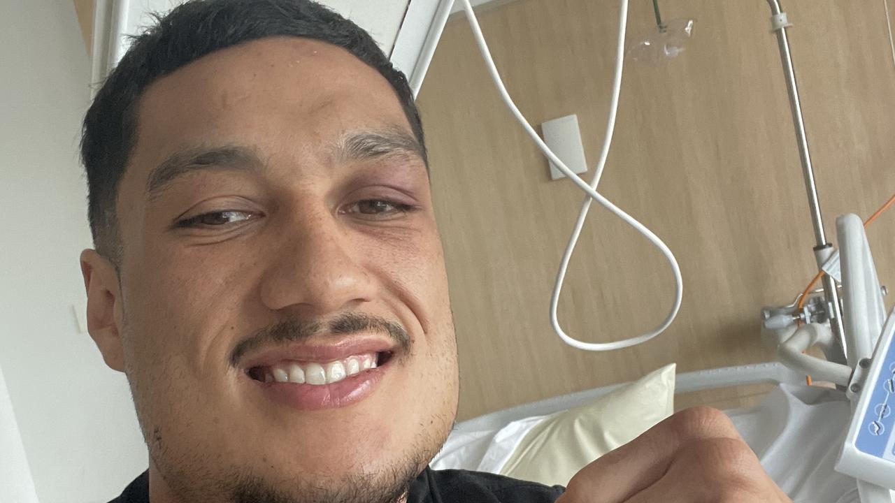 Boxer Jai Opetaia recovers in hospital from a broken jaw.