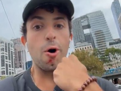 Jared Small told his TikTok followers he was sucked punched in Melbourne's CBD following the Grand Prix. Picture: TikTok