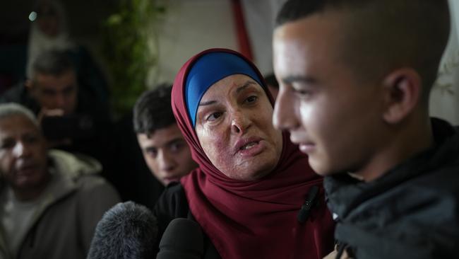 Israa Jaabis is welcomed by her family in East Jerusalem. Picture: Getty Images