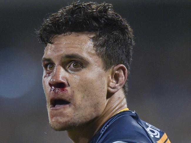 Matt Toomua of the Brumbies (right) reacts after a scuffle during the Round 2 Super Rugby match between the Brumbies and the Waratahs at GIO Stadium in Canberra, Friday, March 4, 2016. (AAP Image/Lukas Coch) NO ARCHIVING, EDITORIAL USE ONLY