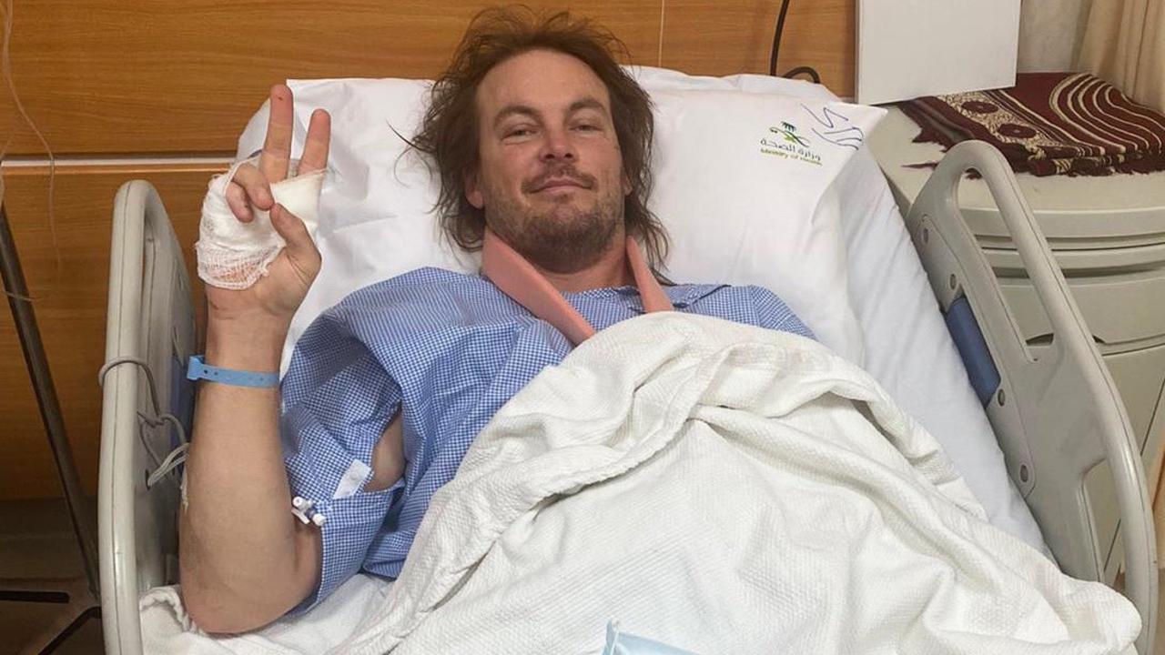 Thirty broken bones and counting for Aussie motorcycle ace Toby Price ...