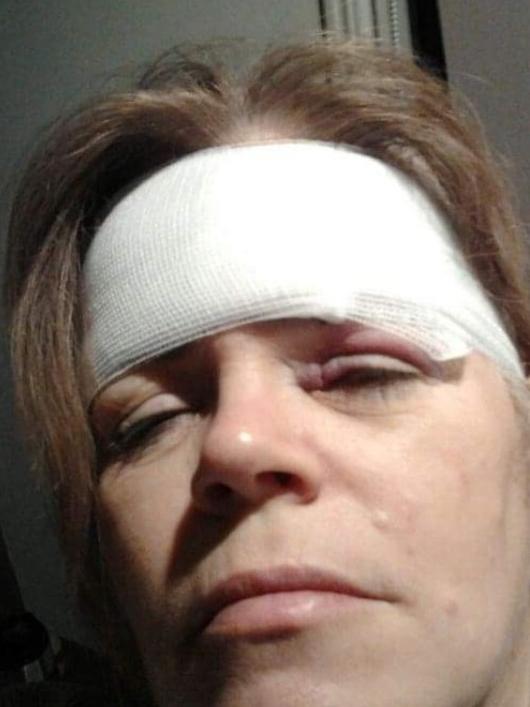 Angela Julienne Kraay after the incident. Picture: Supplied