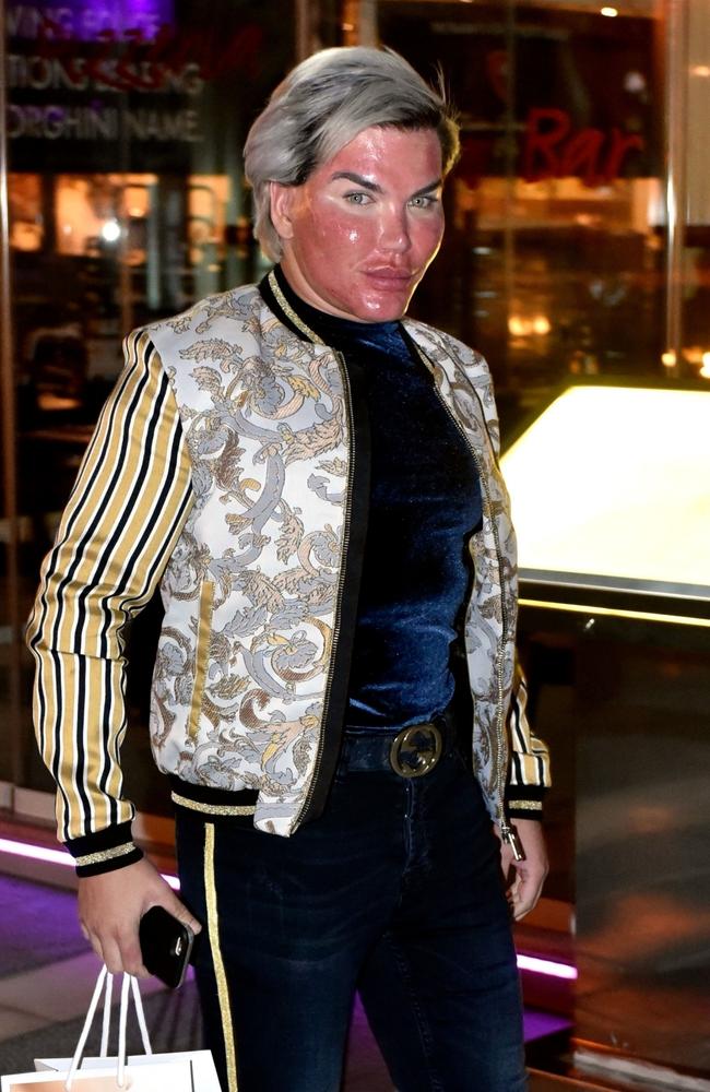 Rodrigo Alves pictured after a chemical facial peel.