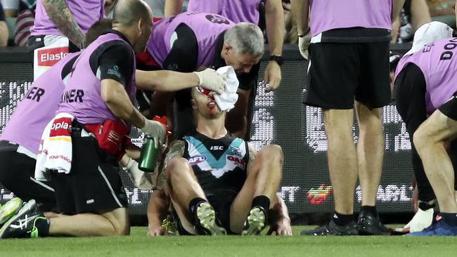 His serious knee injury at training came after a horror night for Hartlett personally against Geelong the weekend prior. Picture: Sarah Reed