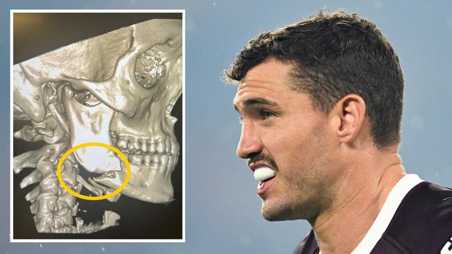 Corey Oates suffered a sickening injury on Friday night.