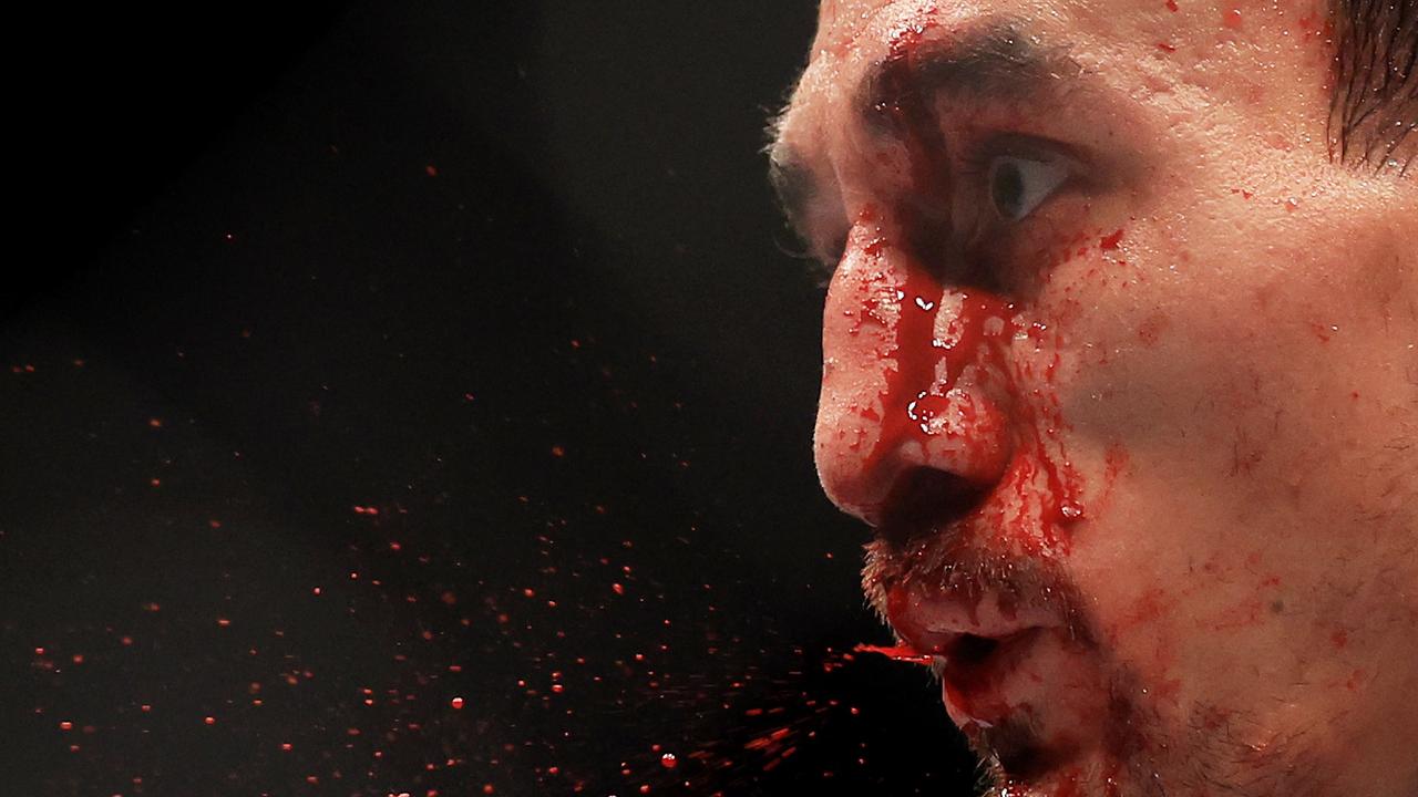 Holloway spent much of the fight whiping blood from his face. Picture: Getty Images/AFP.