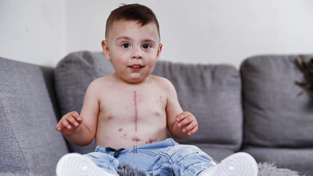 Alexander Kakias had a lifesaving heart transplant. Picture: Sam Ruttyn