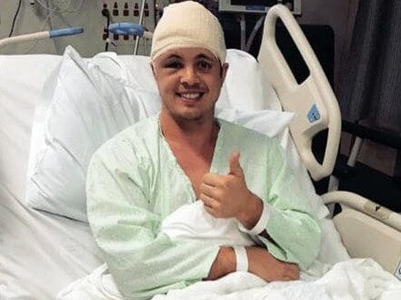 Johnny Ruffo after brain surgery. Picture: Instagram