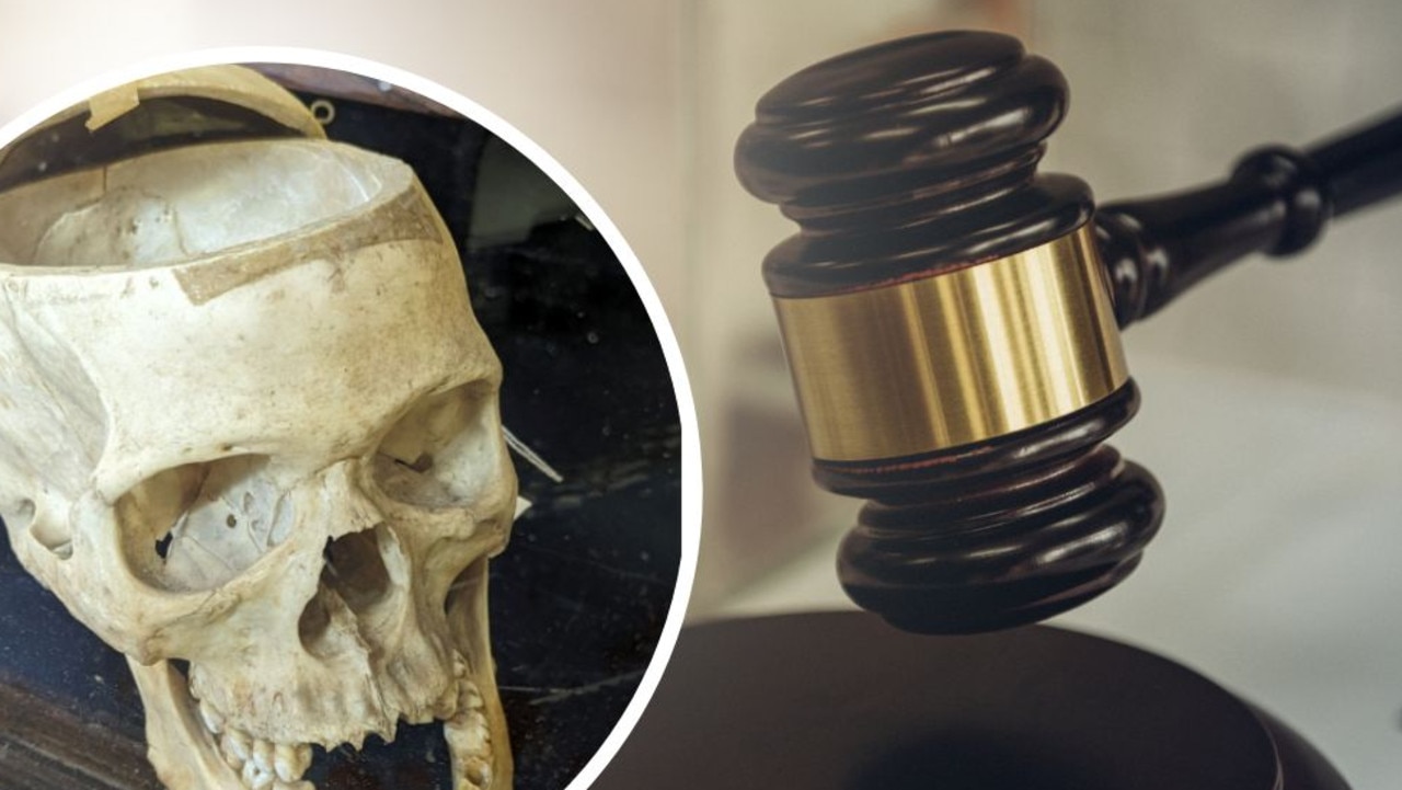 Police probe auction house amid human remains claim