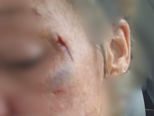 Images have been blurred to protect the victim's identity. Blackman's Gap alleged assault.