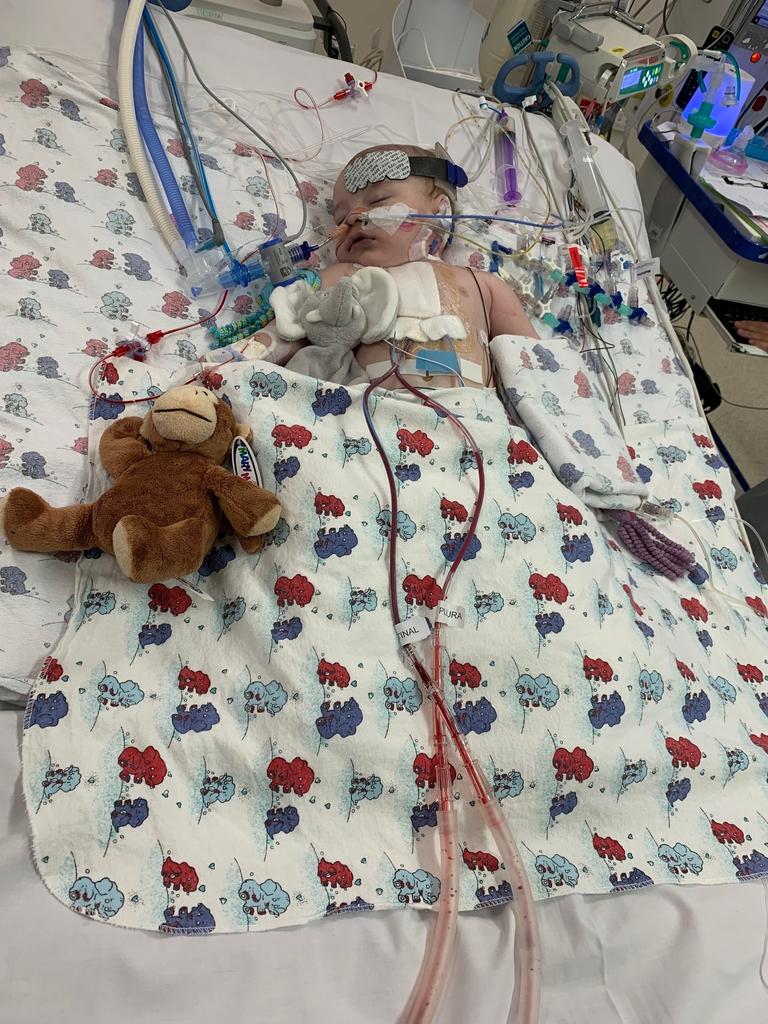 Baby Levi O’Neill has required critical ongoing support, he is pictured here after his second surgery in September 2021. Picture: Supplied.
