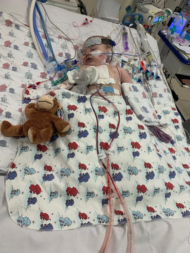 Baby Levi O’Neill has required critical ongoing support, he is pictured here after his second surgery in September 2021. Picture: Supplied.