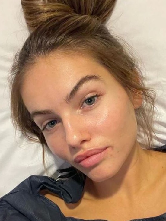 She recently revealed some health issues. Picture: Instagram/ThylaneBlondeau