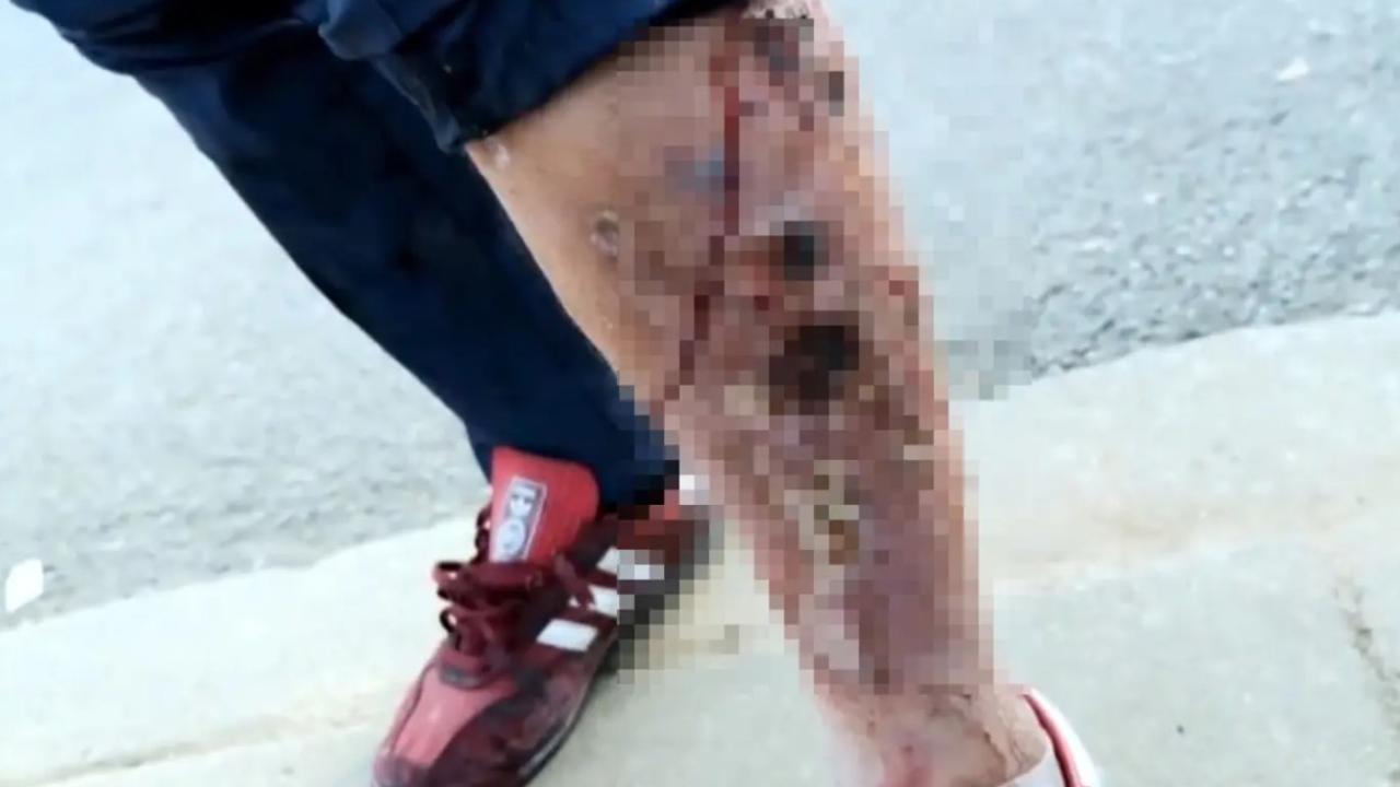 LA officials monitoring rising use of flesh-rotting ‘zombie drug’ tranq. Picture: Sky News UK.