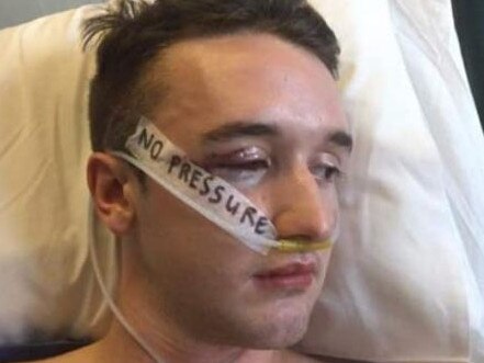 Andrew McNab said he was outraged his attacker hadn’t received a heavier sentence. Picture: Facebook/Andrew McNab