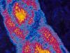 Deadly child respiratory disease surges in SA