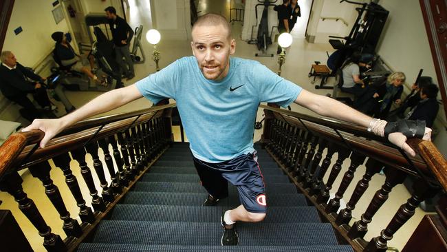 Christian Ashby recovering at the Epworth Hospital in Richmond. Picture: David Caird