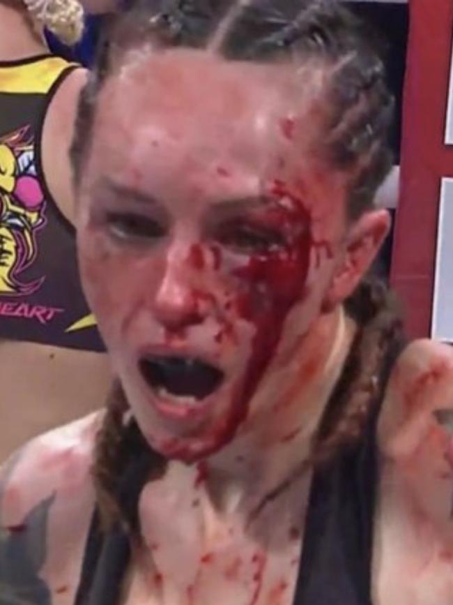 Charisa Sigala after her five round bare knuckle fight.