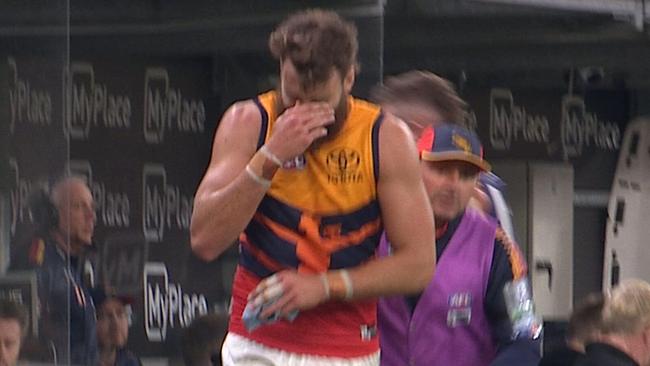 Riley Thilthorpe injury pic is here