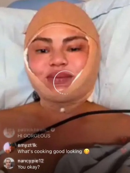 Teigen shocked her followers with this grisly new look this week.