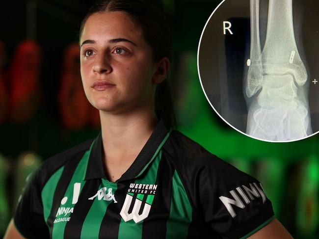 How horrific injury challenged A-League star’s greatest strength