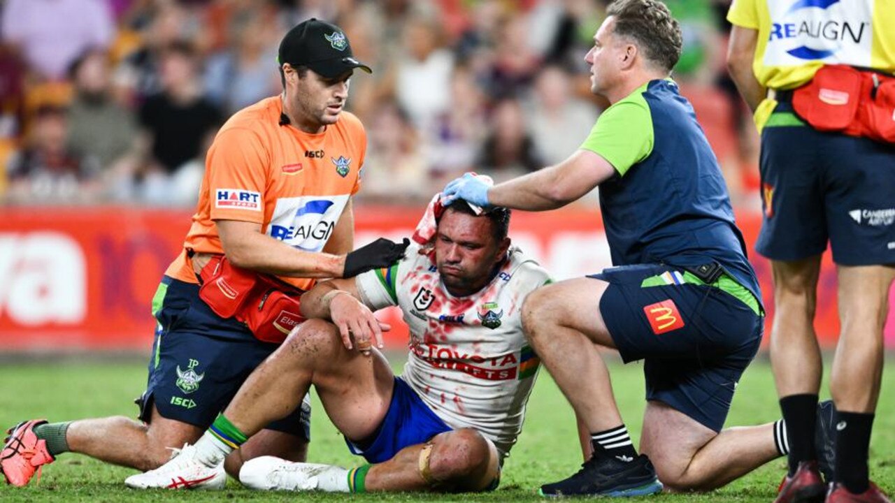 Jordan Rapana copped a nasty head injury. Picture: NRL Photos