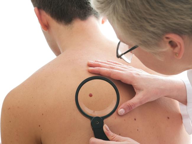 One in 14 men will develop melanoma by the age of 85.