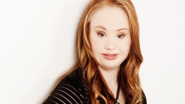 Madeline Stuart is looking to launch a career in modelling. Photo: SUPPLIED