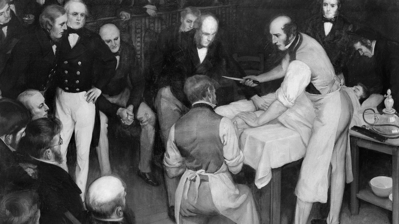 Robert Liston operating. The artist was Ernest Board of Bristol (1877-1934), and this was one of the paintings he was commissioned to paint by Henry S. Wellcome circa 1912. Credit: Wellcome Collection.