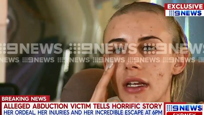 Cheyane Lubec spoke to Nine News about the ordeal and outlined the injuries she was left with. Picture: Nine News