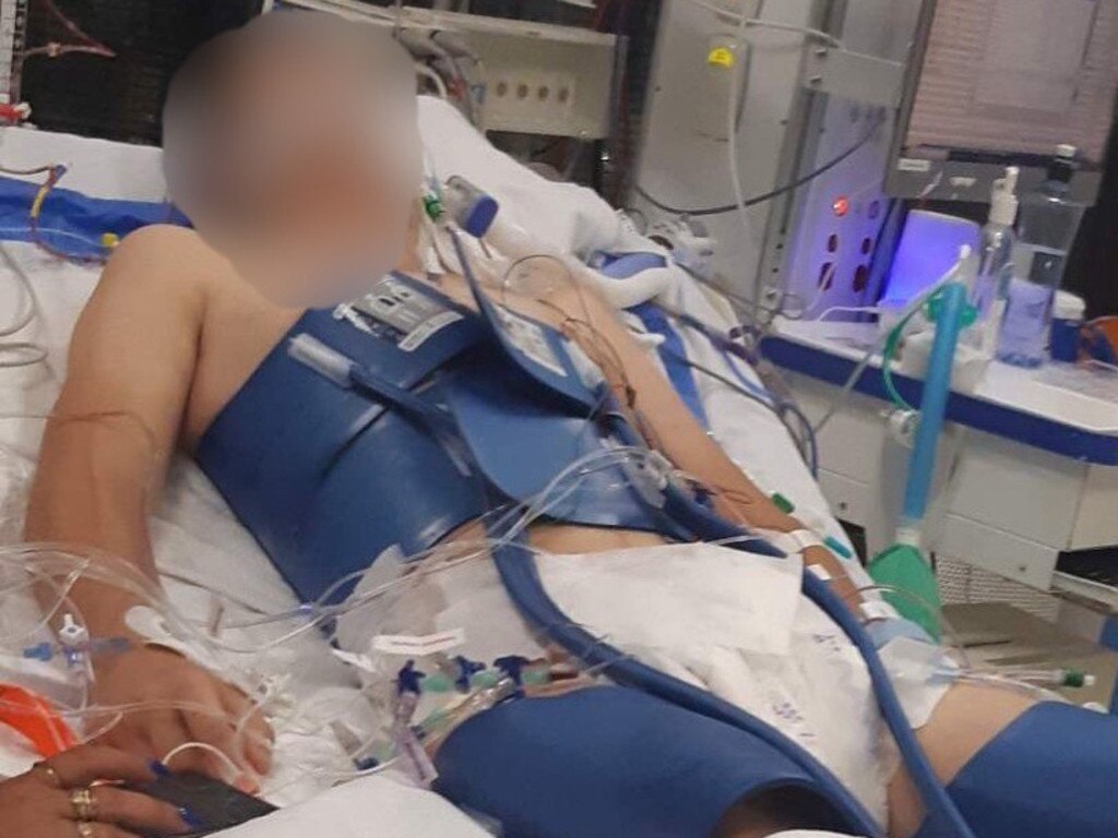 The Maryborough teenager is still fighting for life in hospital after an alleged skatepark attack.
