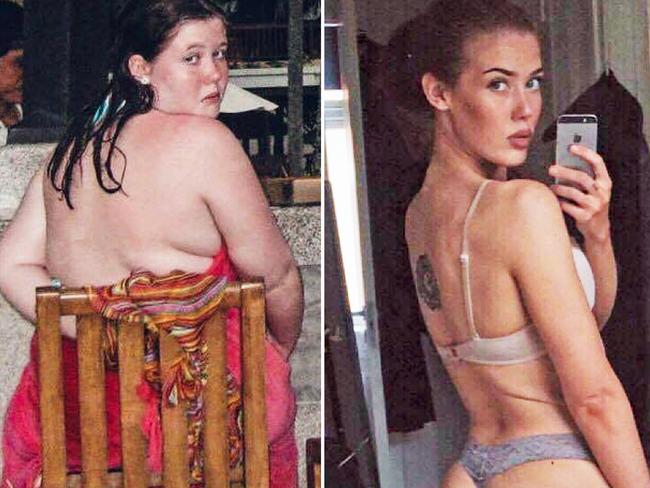 How she went from obese to model