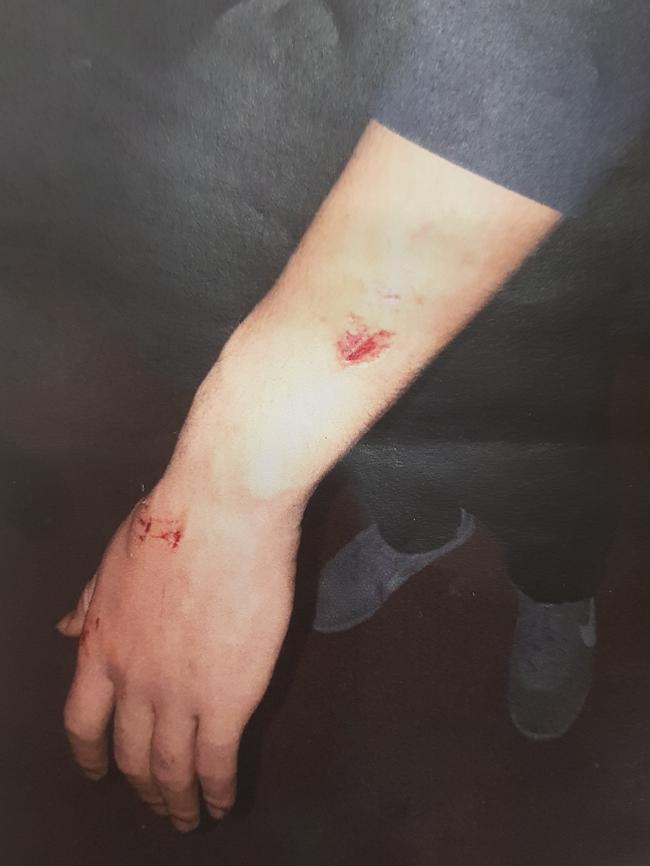 Police photograph tendered to court of Fan Chi Kong’s arm. Picture: SA Police