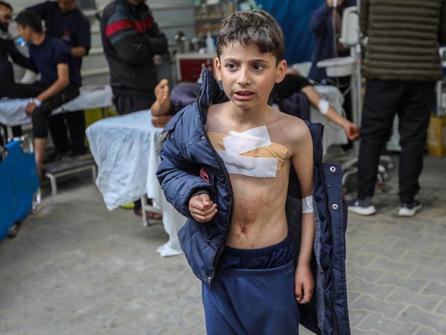 A young Palestinian injured in Israeli air strikes is treated at Kuwait Hospital on January 08, 2024 in Rafah, Gaza. Picture: Ahmad Hasaballah/Getty Images