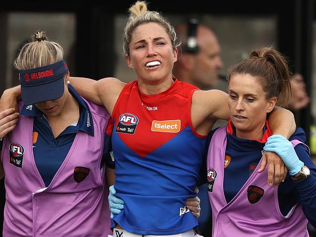 MELBOURNE, AUSTRALIA - MARCH 11:  Melissa Hickey of the Demons leaves the ground with an injury during the round six AFLW match between the Carlton Blues and the Melbourne Demons at Ikon Park on March 11, 2018 in Melbourne, Australia.  (Photo by Robert Cianflone/Getty Images)