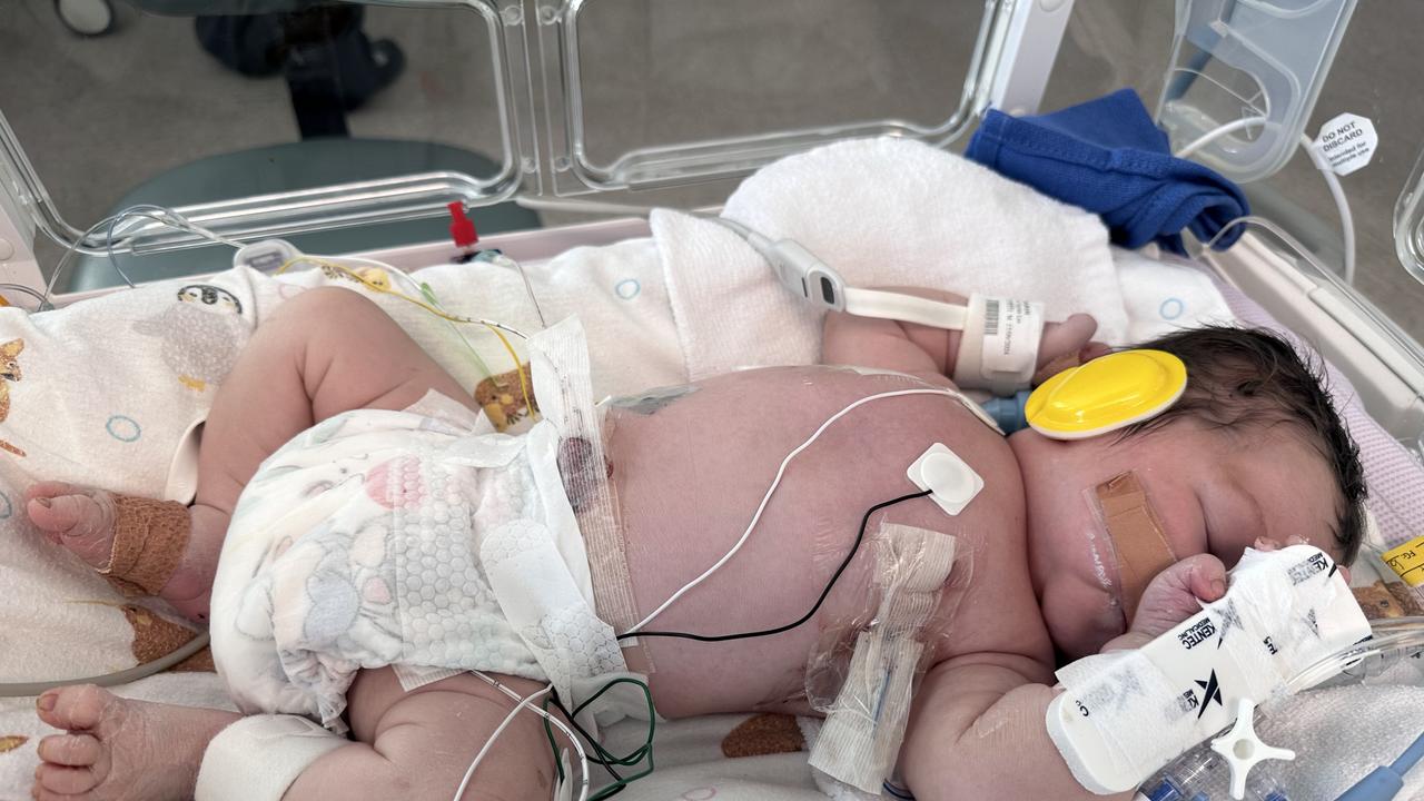 New mum tells harrowing tale of how Roma’s cutest baby was born