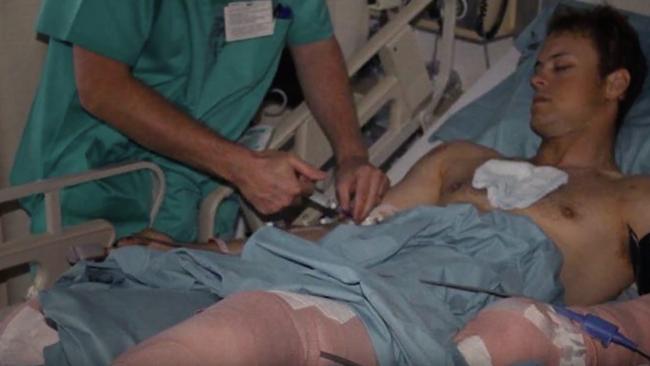 Curtis McGrath, veteran and Paralympian, was hospitalised in Afghanistan after he stood on a landmine. Picture: Supplied.