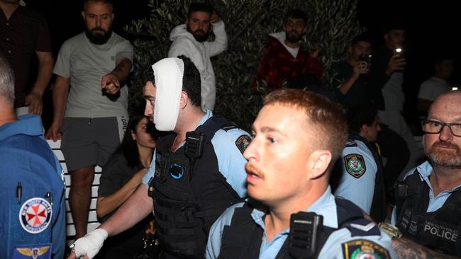 A police officer is seen with a bandaged head amid the mayhem. Picture: Liam Mendes