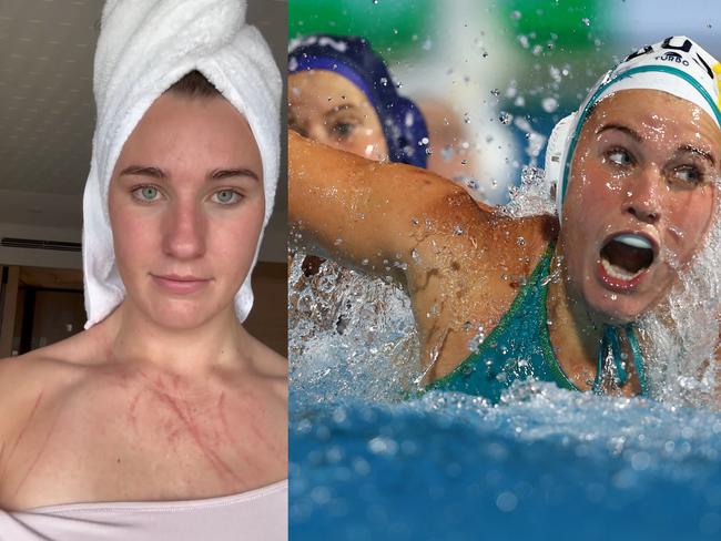 Tilly Kearns took to social media to display her scars from a brutal match.