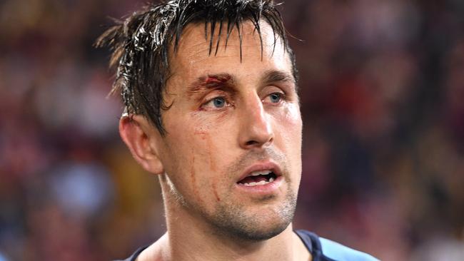 Will Mitchell Pearce come back for more Origin pain? (AAP Image/Dave Hunt)